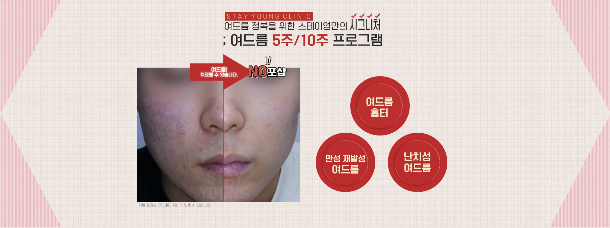 내부사진