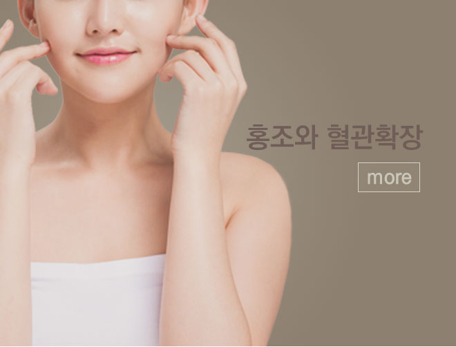 홍조와 혈관확장 바로가기
