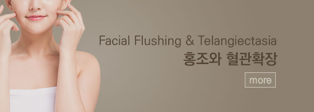 홍조와 혈관확장 바로가기