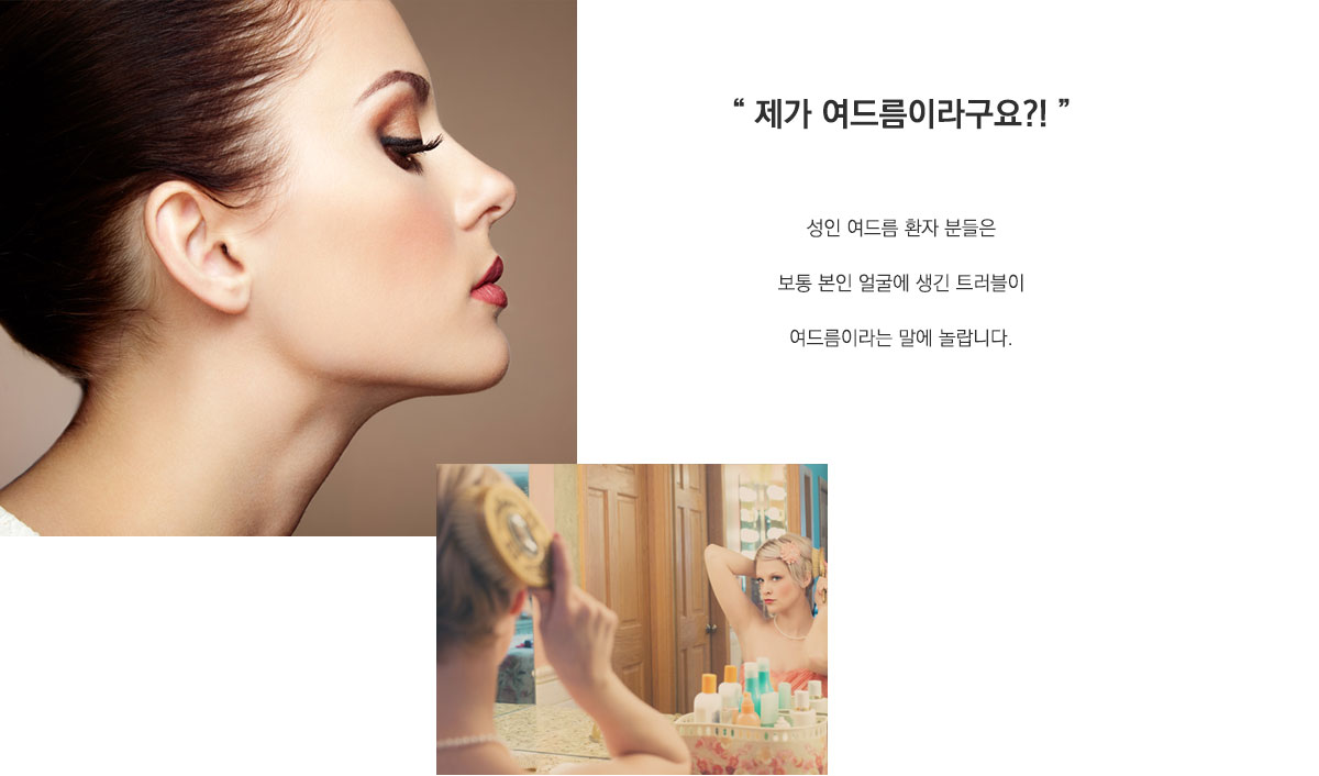 제가 여드름이라구요?! 성인 여드름 환자분들은 보통 본인 얼굴에 생긴 트러블이 여드름이라는 말에 놀랍니다.