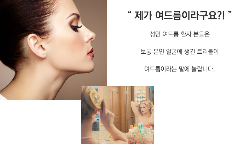 제가 여드름이라구요?! 성인 여드름 환자분들은 보통 본인 얼굴에 생긴 트러블이 여드름이라는 말에 놀랍니다.